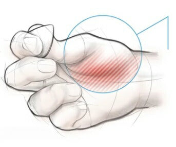 BOG STREET - LEAP Series Mix 6